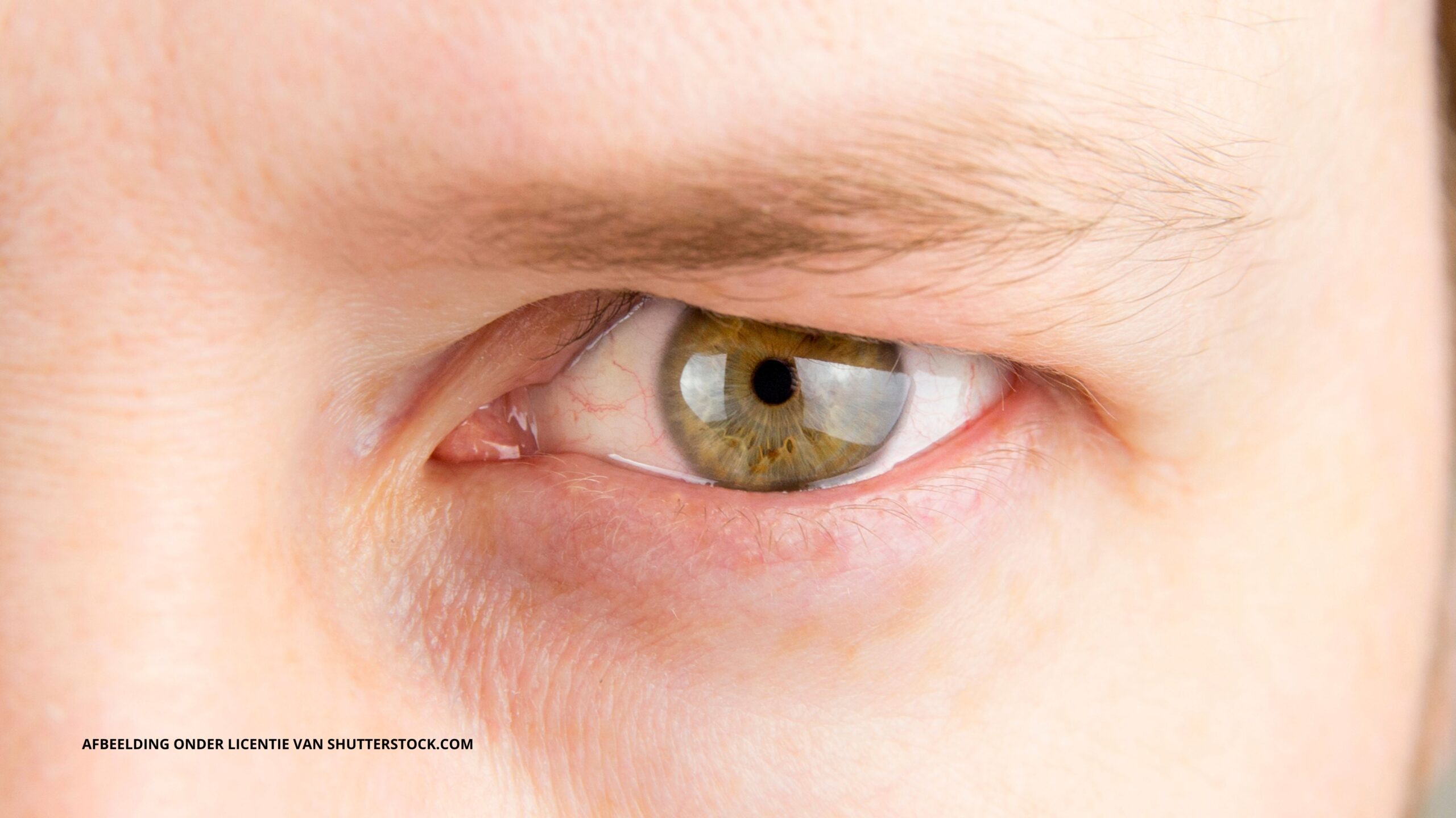 Ooglidcorrectie en wenkbrauwlift